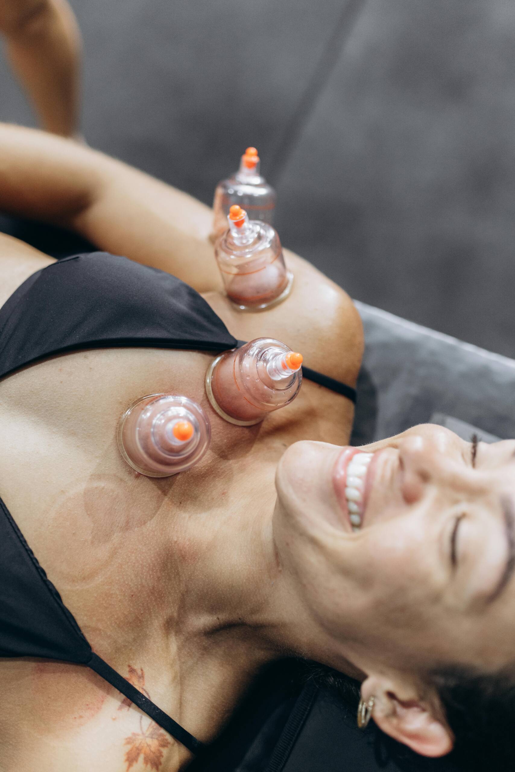 Cupping